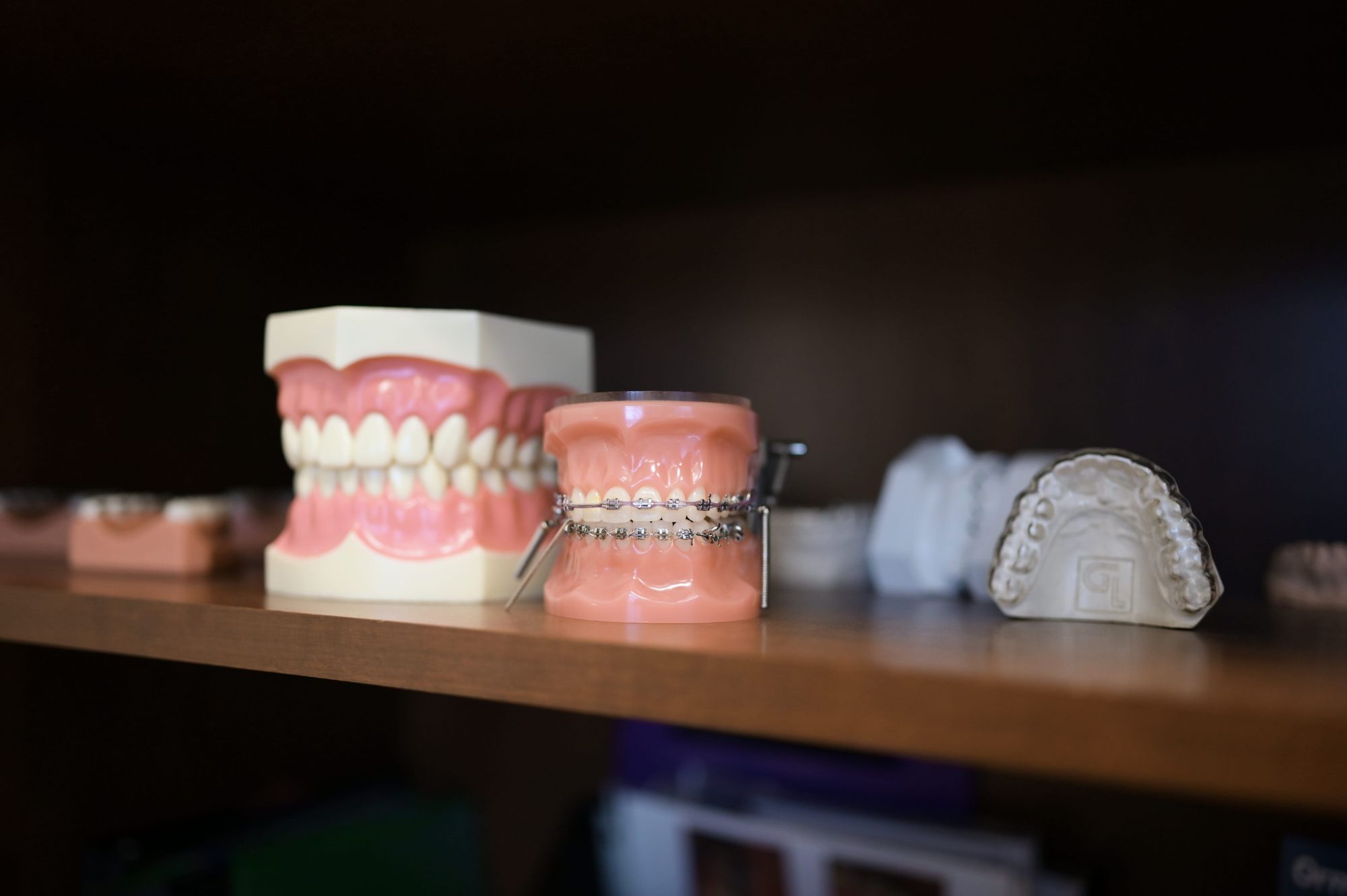 TMJ Therapy Orthodontics Windsor Orthodontist Fort Collins