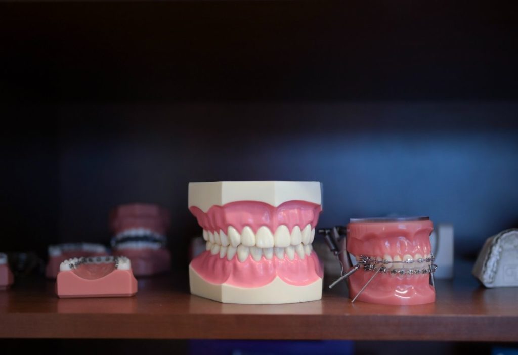 5 Things You Will Not Get With Mail-Order Orthodontics
