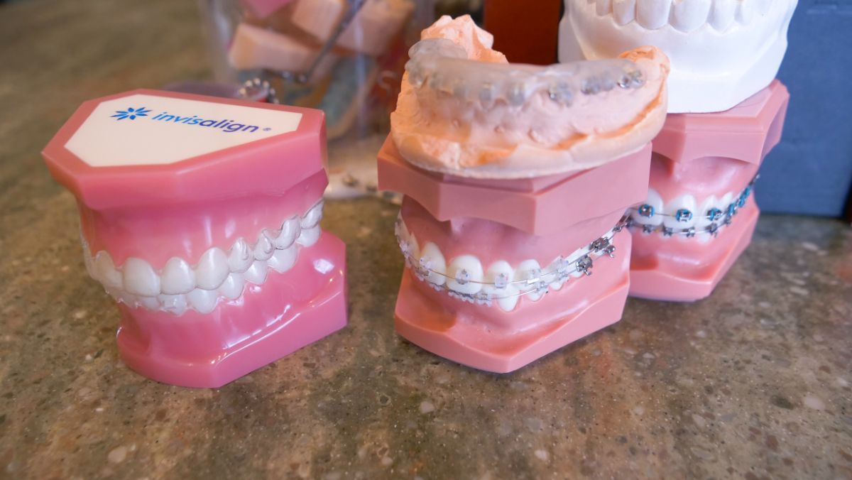 3 Keys To Creating Beautiful Smiles With Aligners