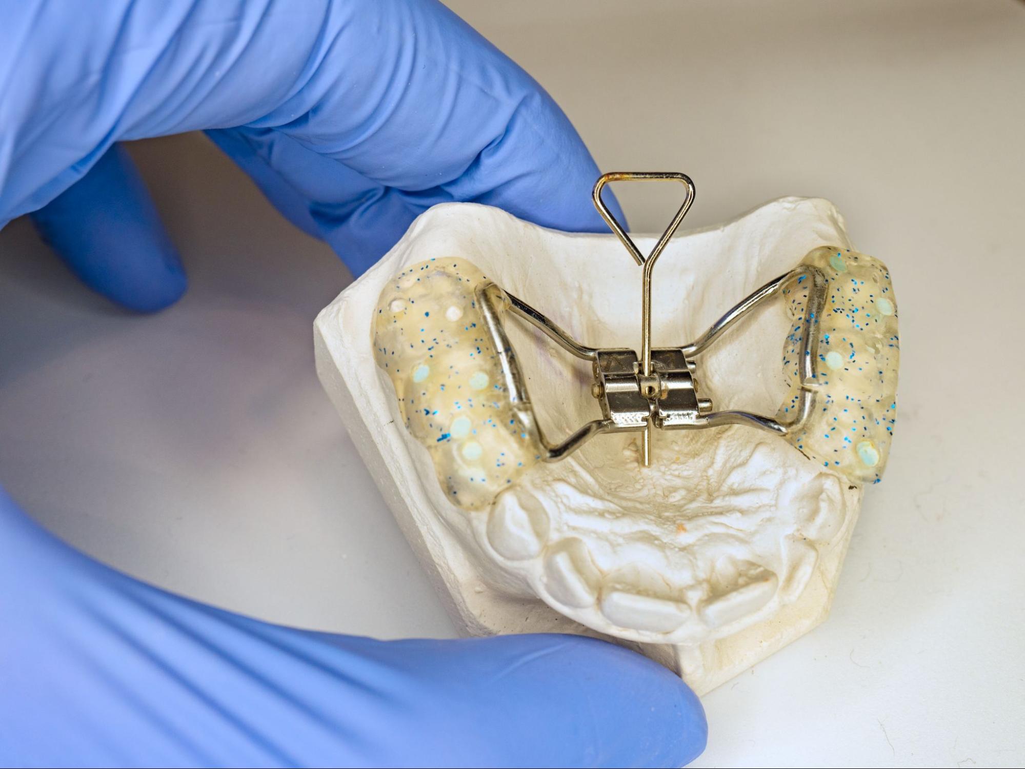 What Are Interceptive Orthodontics?